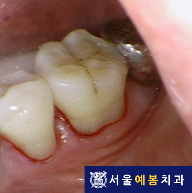 서울예봄치과 이미지