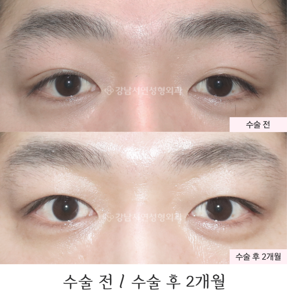 서연성형외과의원 이미지