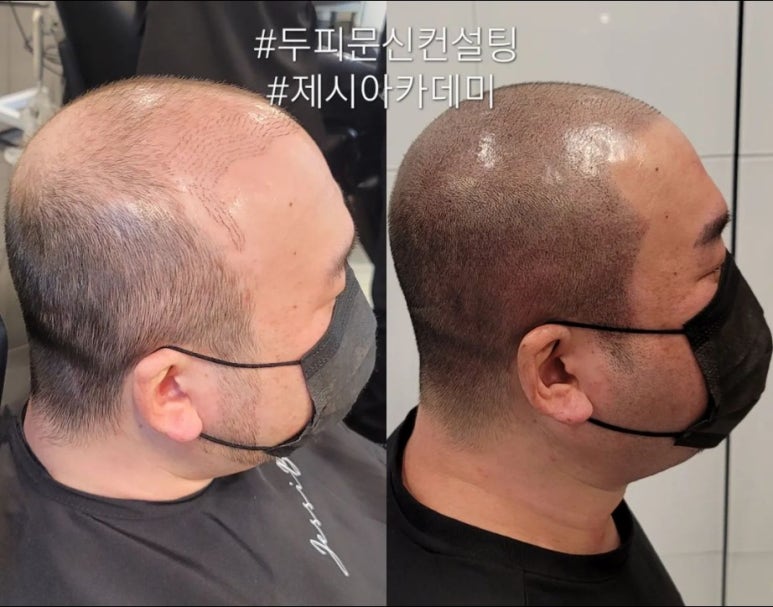 라인컨설팅 이미지