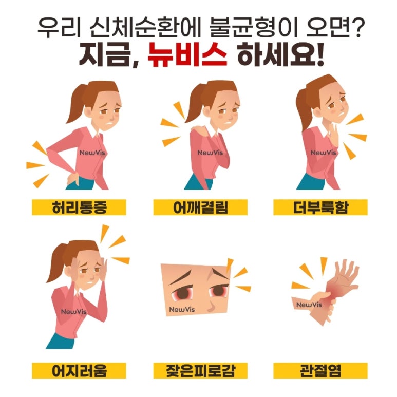 뉴비스 이미지