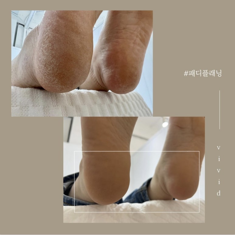 비비드순 이미지