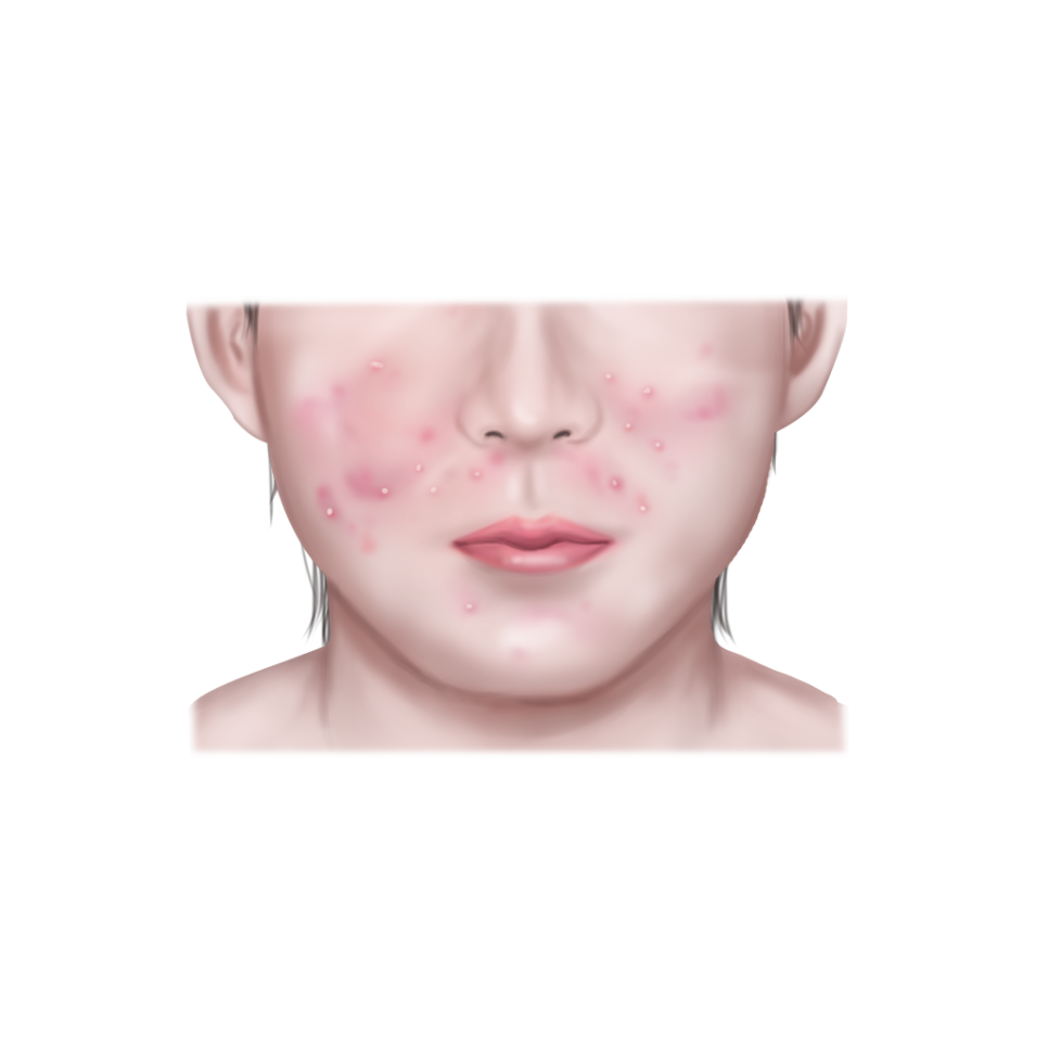 미백피부샵 이미지