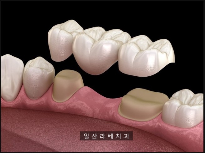 라페치과 이미지