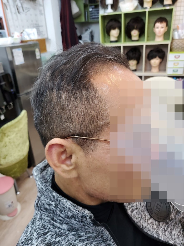 셀모가발 이미지