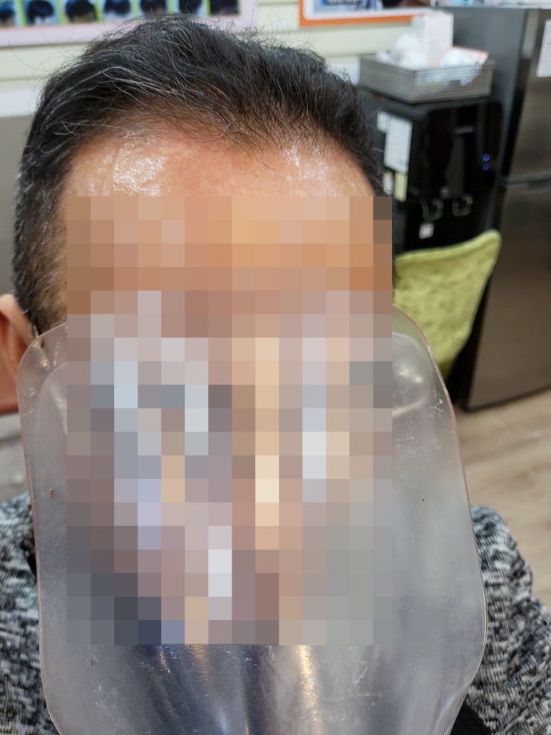 셀모가발 이미지