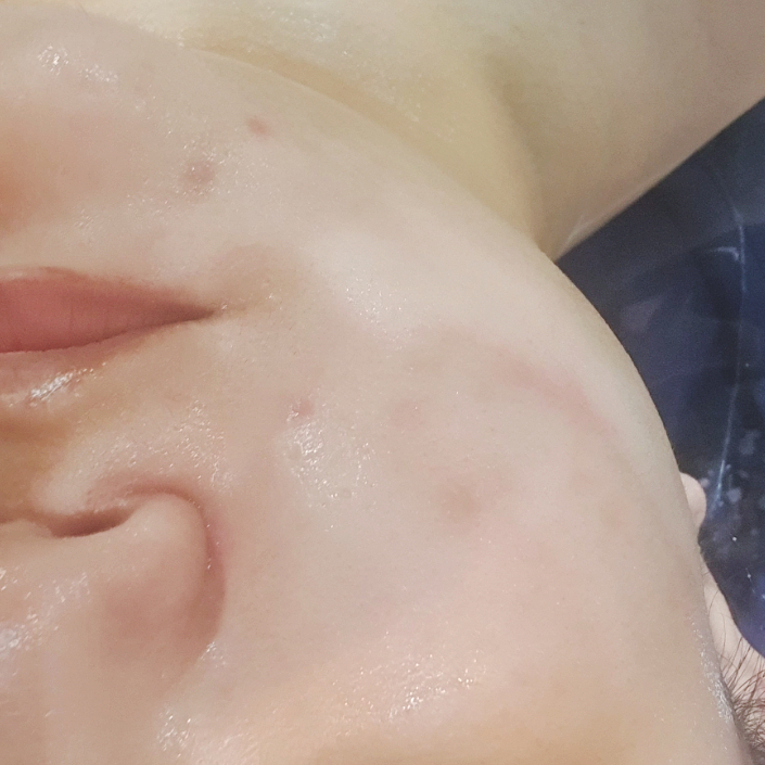 오광케어 이미지