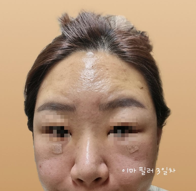 비티에프 이미지