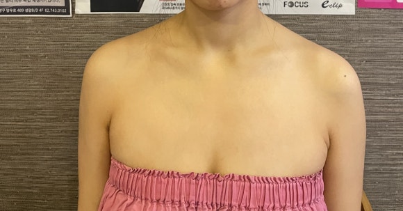 구해진피부사랑 이미지