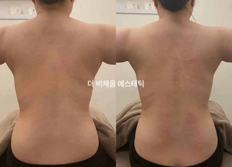 채움에스테틱 이미지