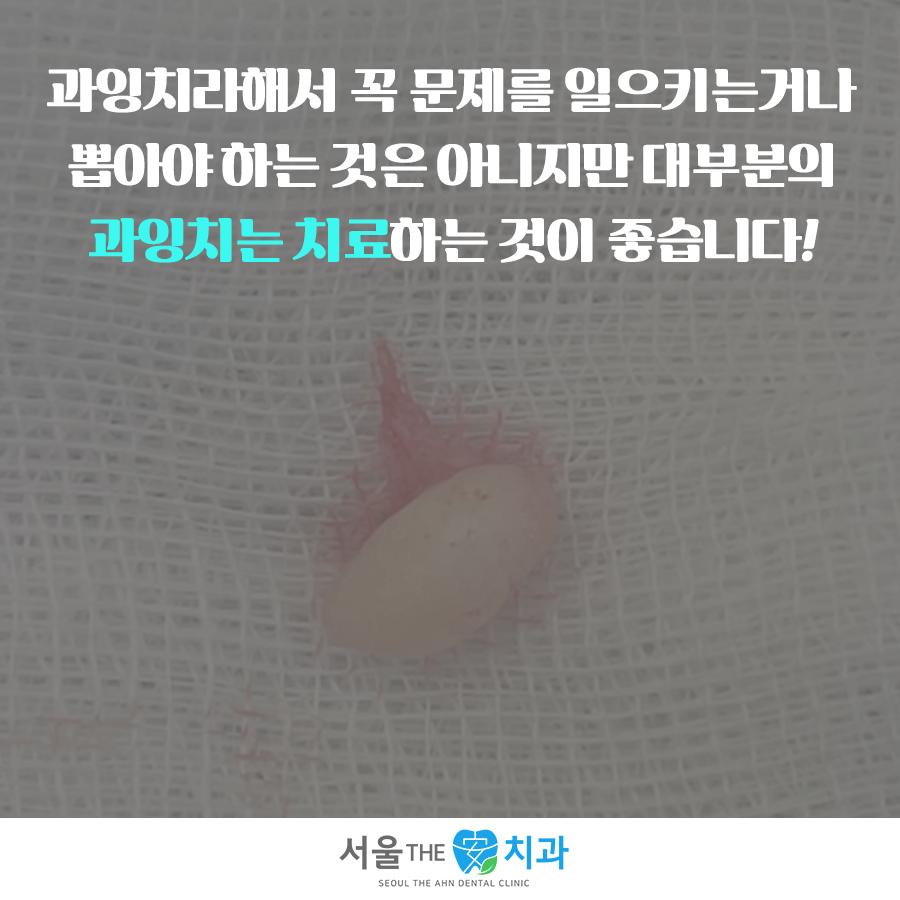 서울더안치과의원 이미지