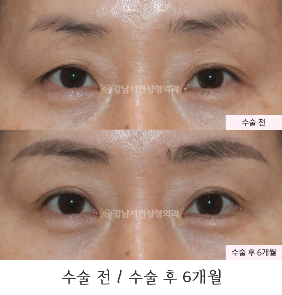서연성형외과의원 이미지