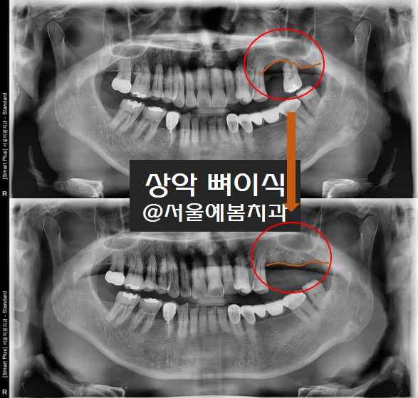 서울예봄치과 이미지