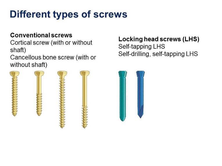 OS screw 에 대하여 (cortical vs cancellous) 네이버 블로그