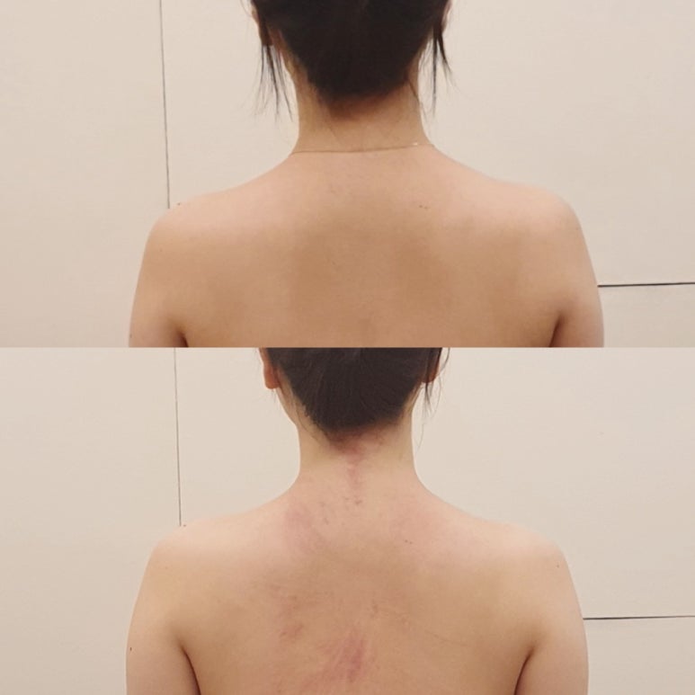 채움에스테틱 이미지