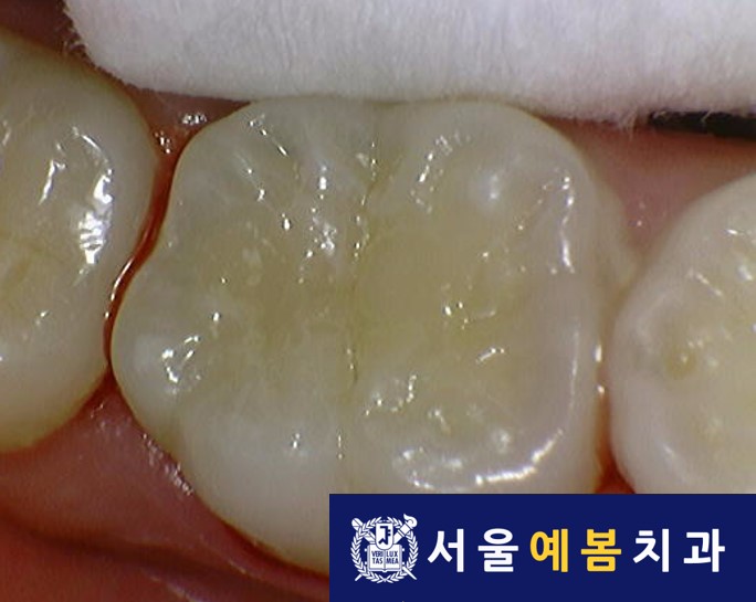 서울예봄치과 이미지