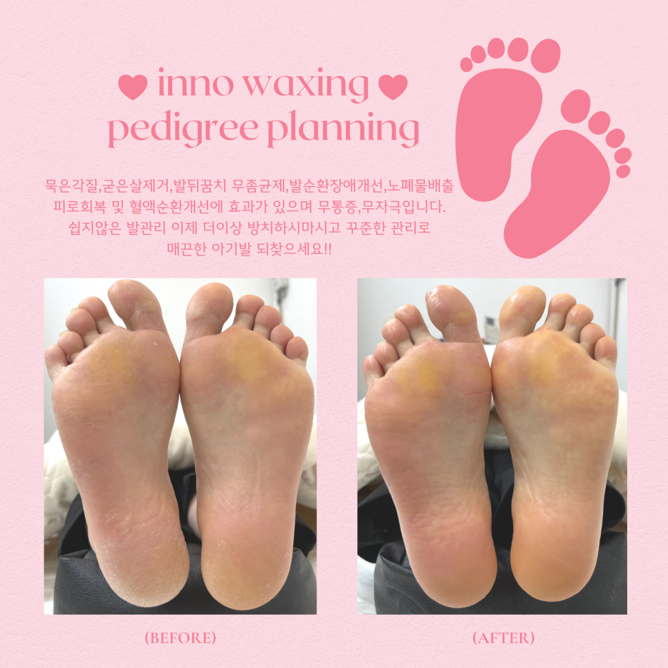 이노플래닝 이미지