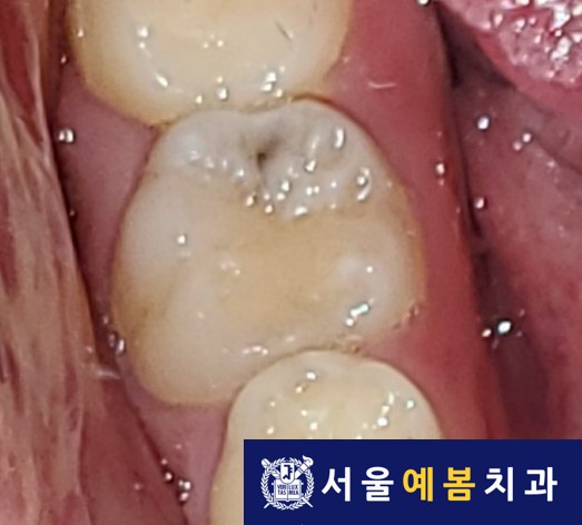 서울예봄치과 이미지