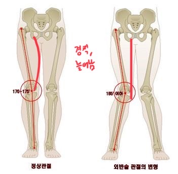 멧피트니스 이미지