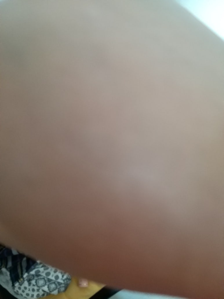 메디뷰 이미지