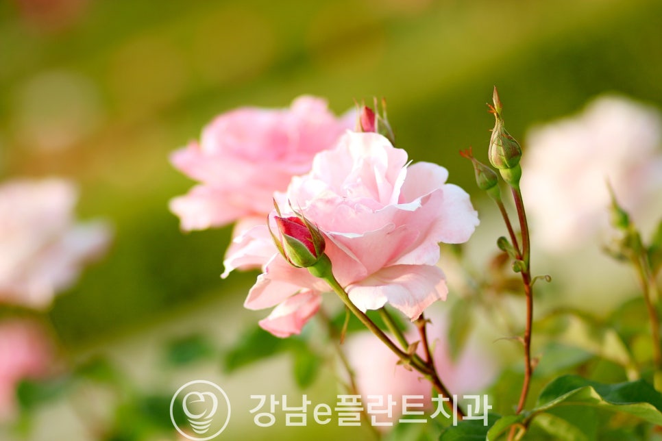 e-플란트치과 이미지