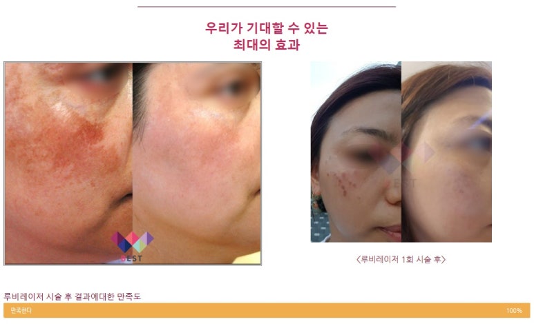 베스트피부과의원 이미지