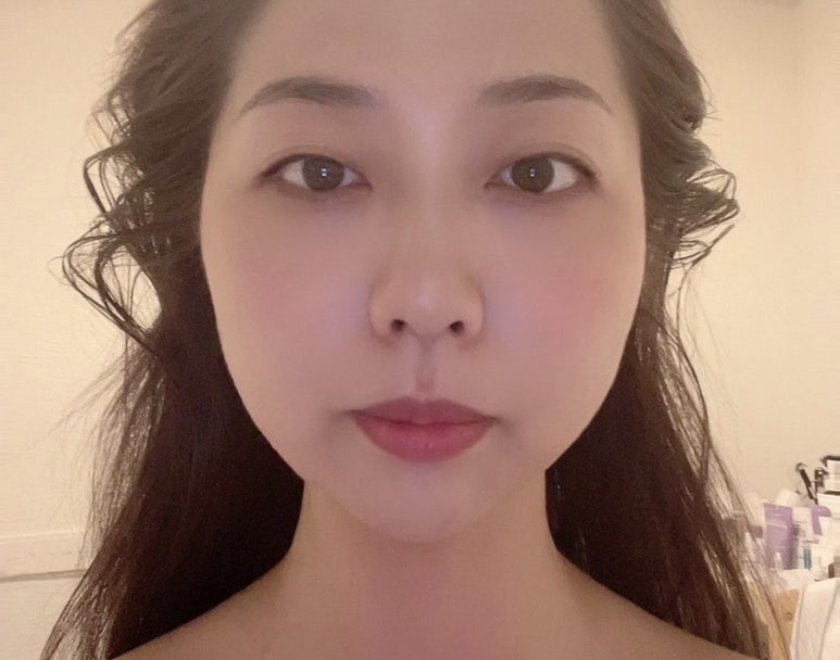 오호 에스테틱 이미지