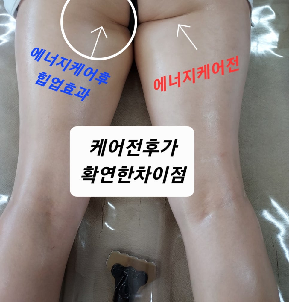 미즈스킨케어 이미지
