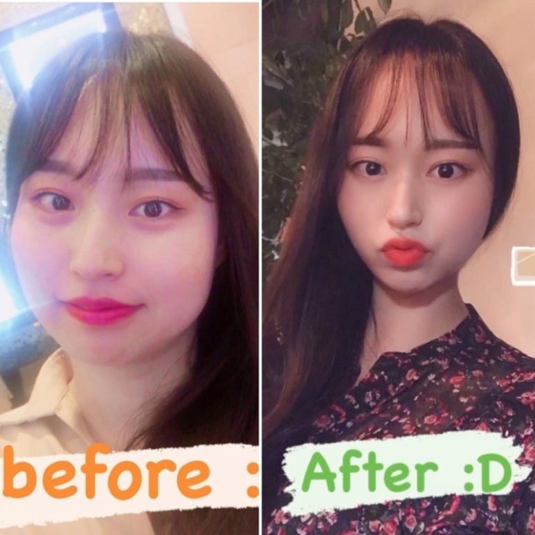 내몸엔점핑 이미지