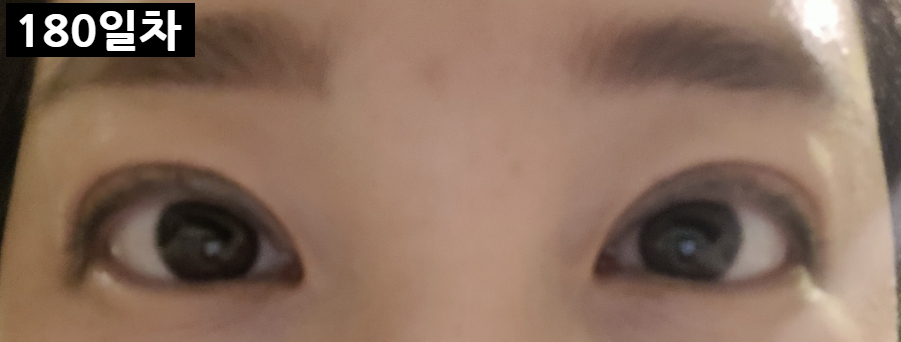 오킴스케이성형외과 이미지