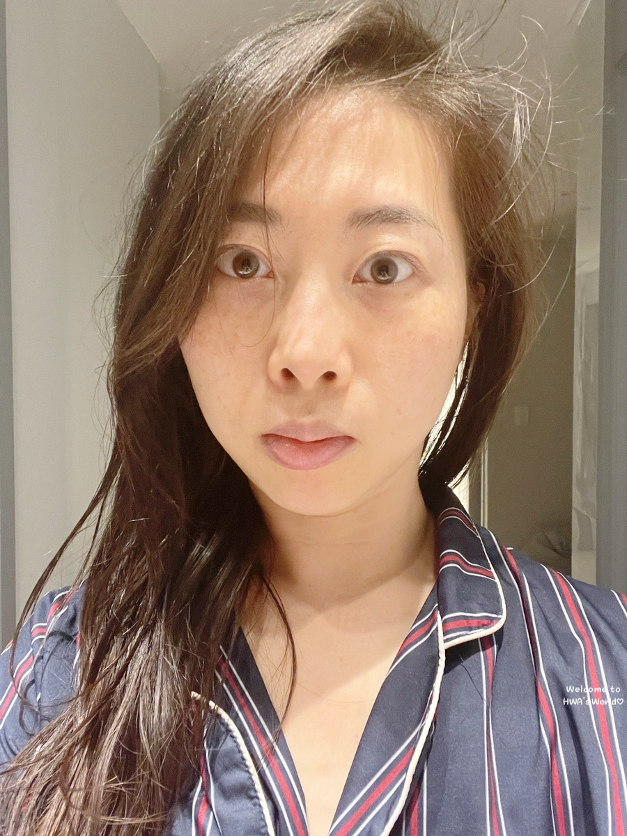 폴라인에스테틱 이미지