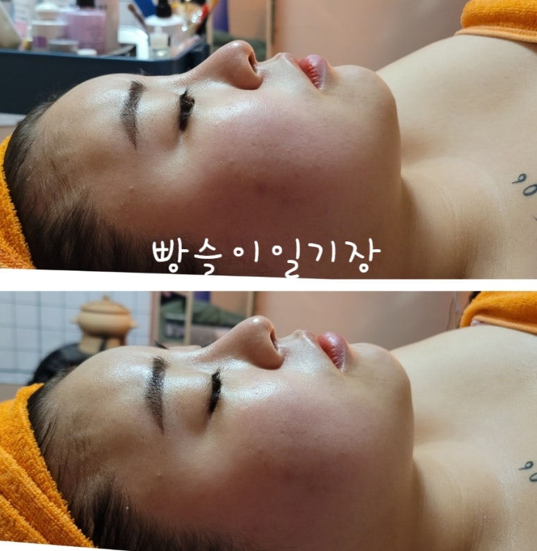 람세스피부관리 이미지