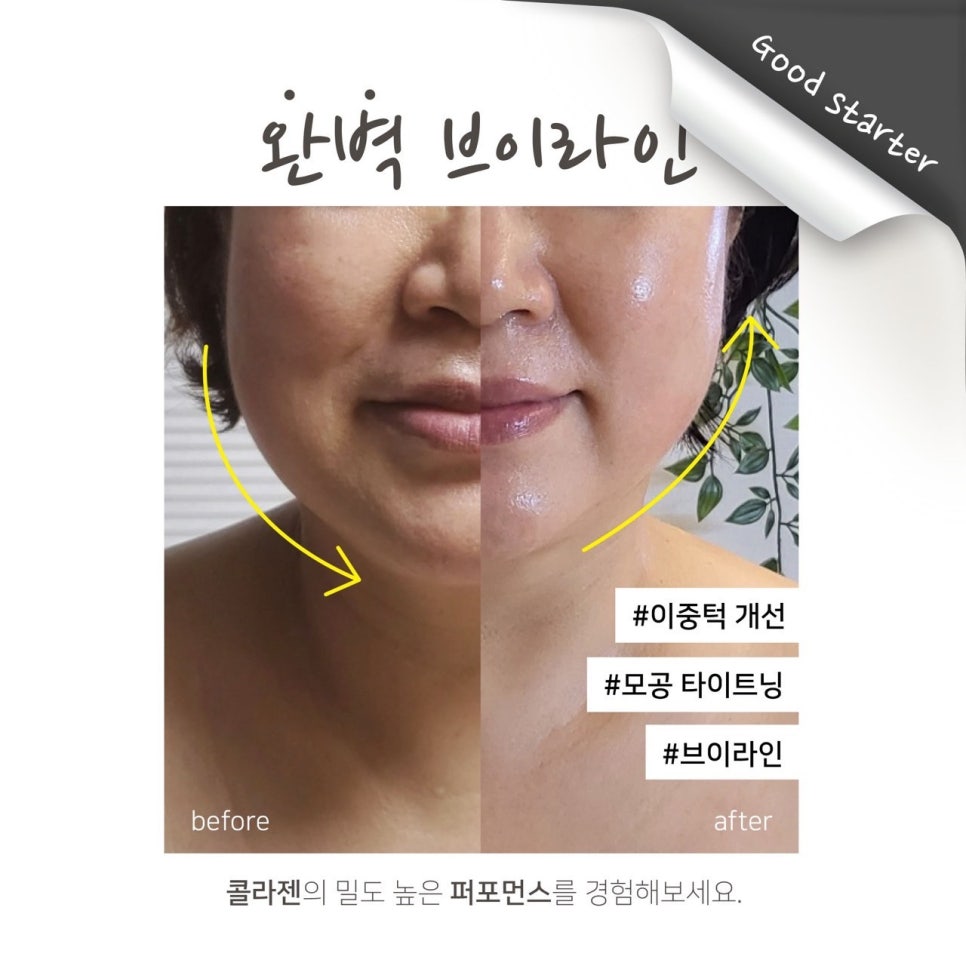 오뉴에스테틱 이미지