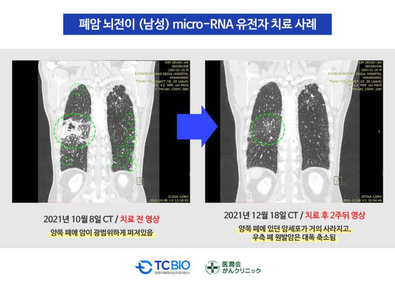 티시바이오 이미지