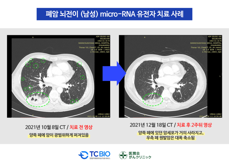 한국미디어주 이미지