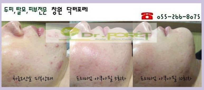 필이벤트 이미지