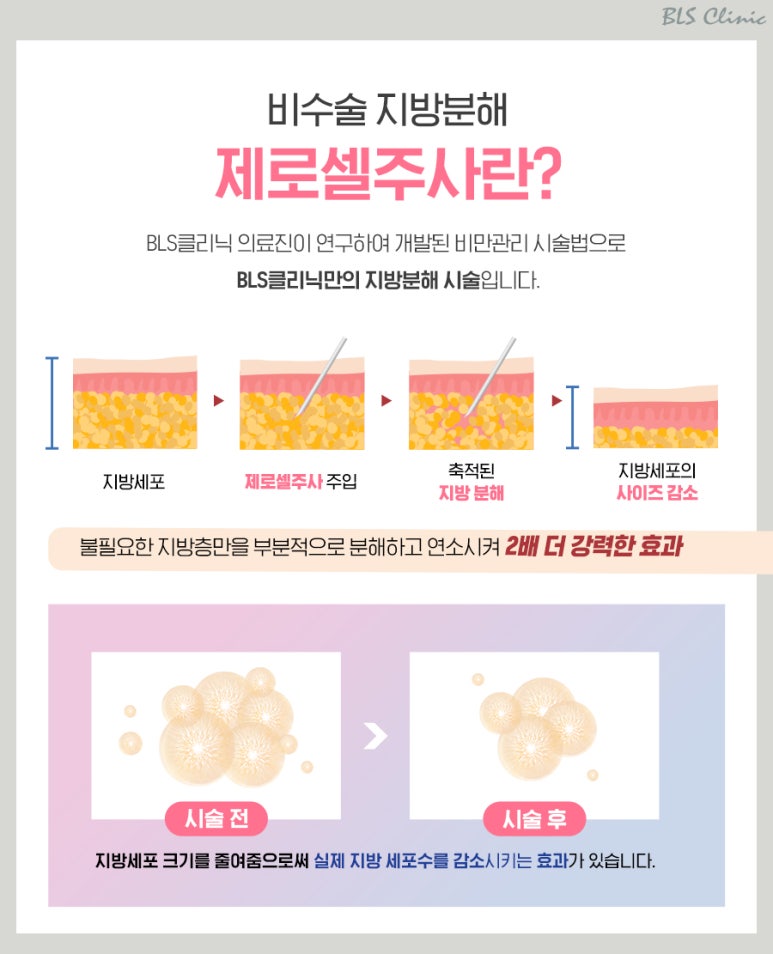 비엘에스의원 이미지