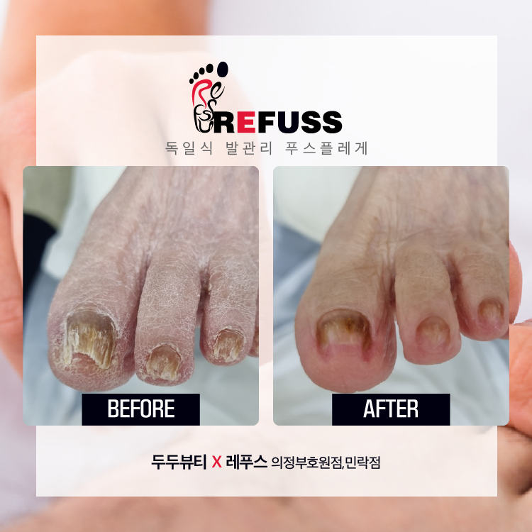 레푸스앤두두뷰티 이미지