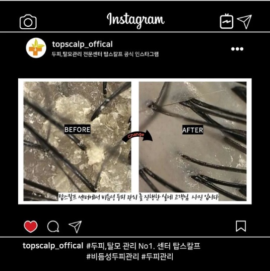 탑스칼프 강서마곡점 이미지