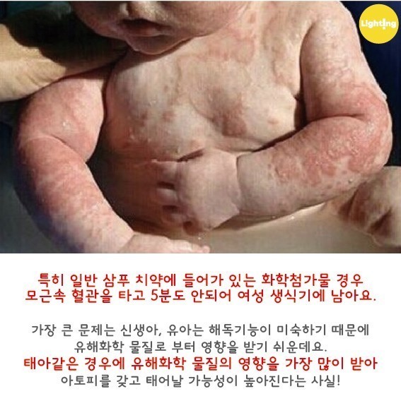 체인지스킨 이미지