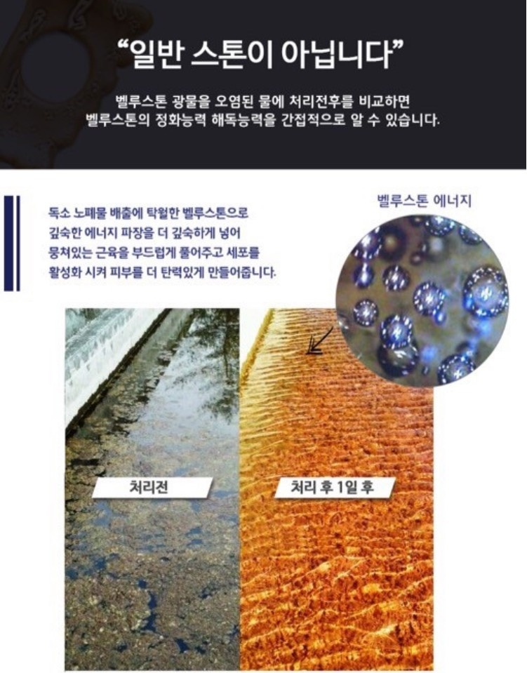 퀸테라피 이미지
