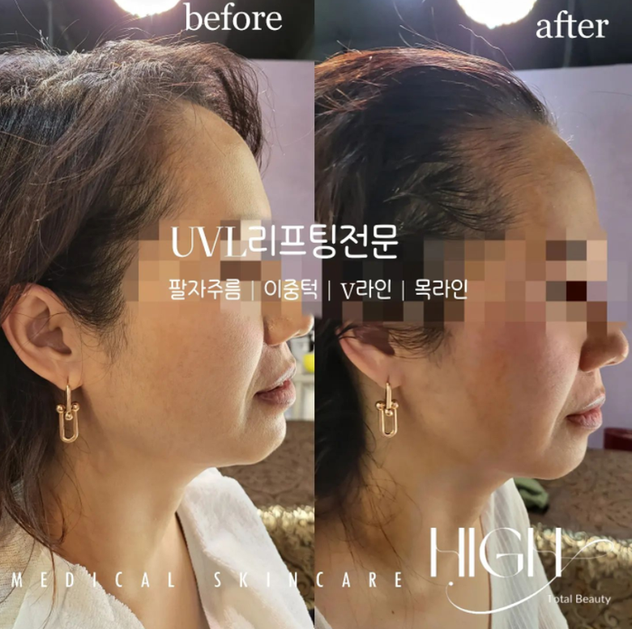 하이뷰티 이미지