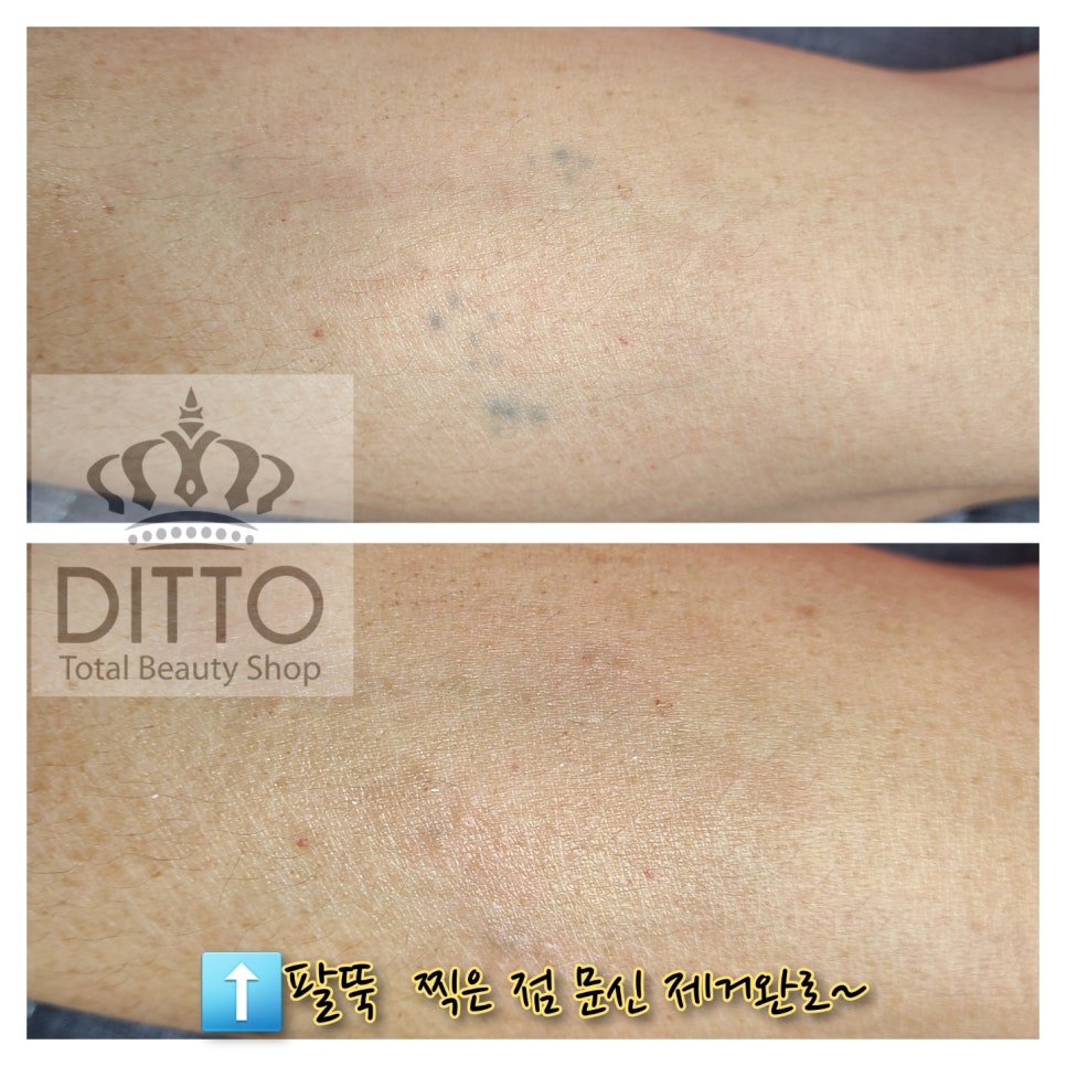 디토뷰티(Ditto beauty) 이미지
