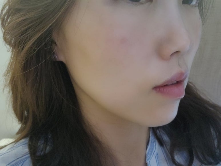 청에스테틱 이미지