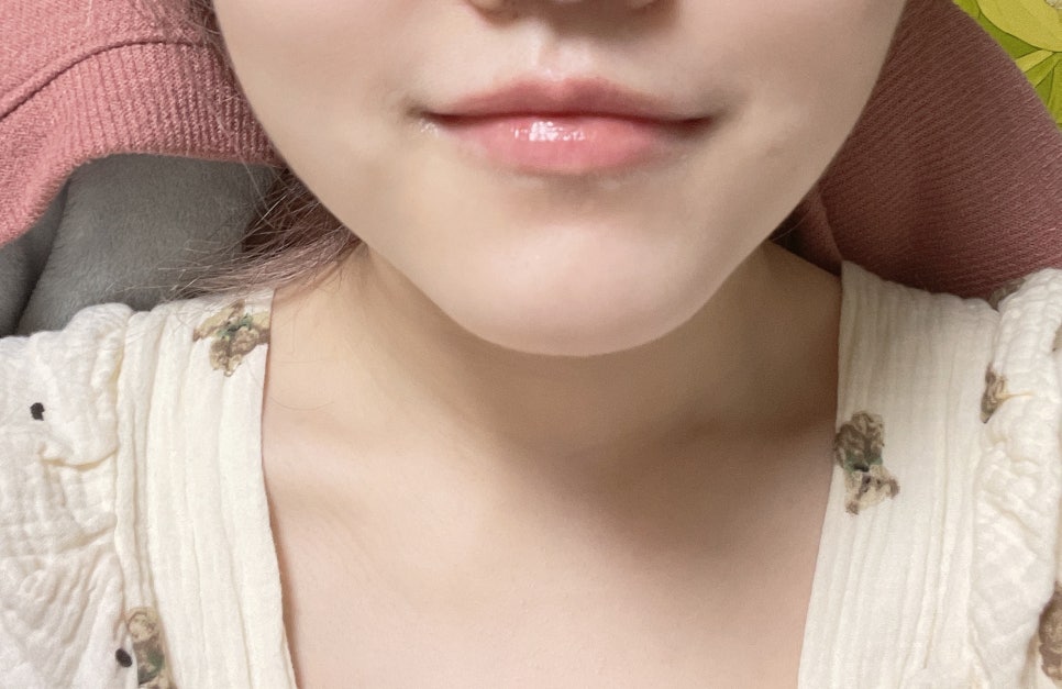 멀티팜 이미지