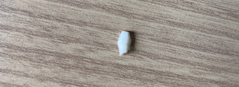 훈키즈치과 이미지