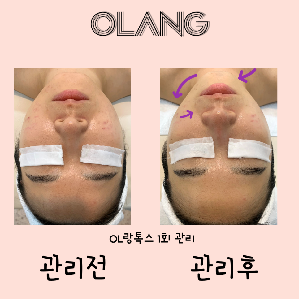 베네핏 에스테틱 이미지