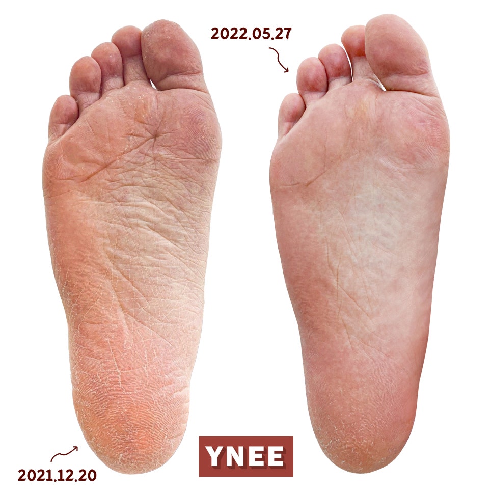 YNEE(와이니네일) 이미지