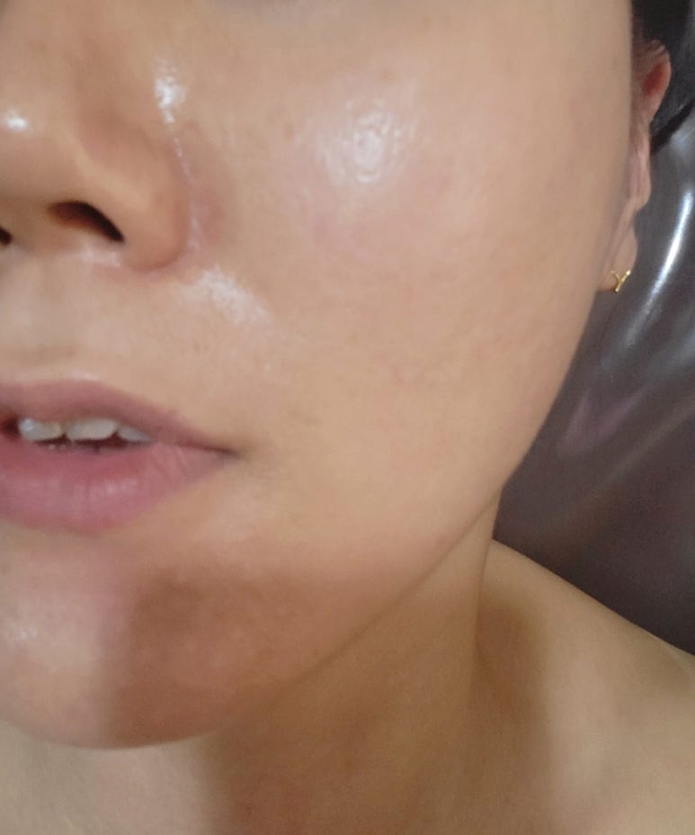 S바디앤스킨 이미지