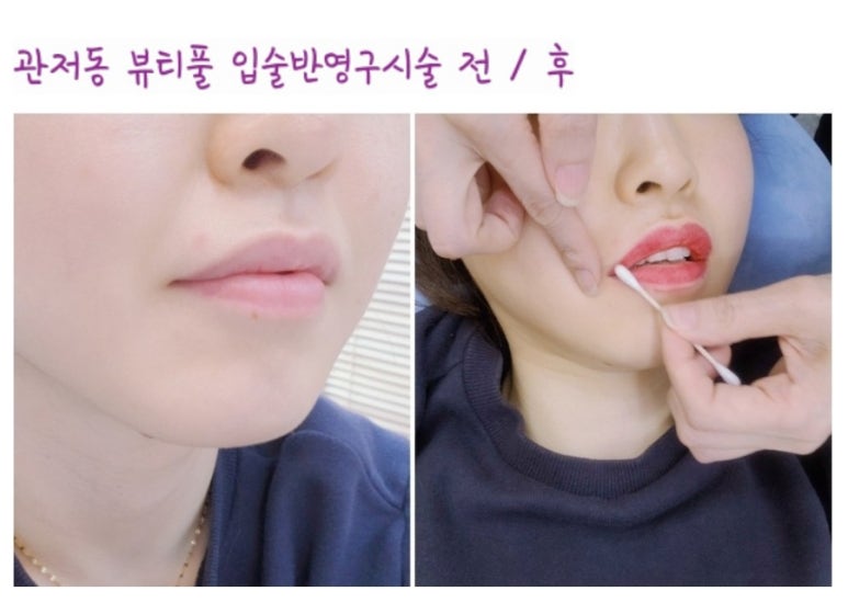 채우다 beauty# 이미지