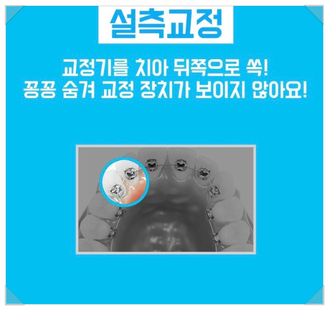 예치과의원 이미지